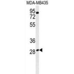 Ras-Related GTP-Binding Protein D (RRAGD) Antibody