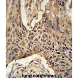 Lipid Phosphate Phosphatase-Related Protein Type 4 (LPPR4) Antibody