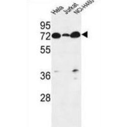 Lipid Phosphate Phosphatase-Related Protein Type 4 (LPPR4) Antibody