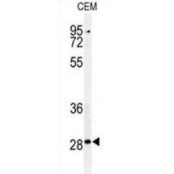 Caspase 3 (CASP3) Antibody