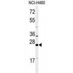 RAB27B, Member RAS Oncogene Family (RAB27B) Antibody