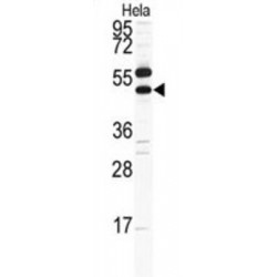 Carbonic Anhydrase 9 (CA9) Antibody