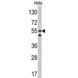 Carbonic Anhydrase 9 (CA9) Antibody