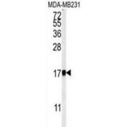 WB analysis of MD-MB231 cell line lysates (35 µg/ml), using AP1S1 antibody.