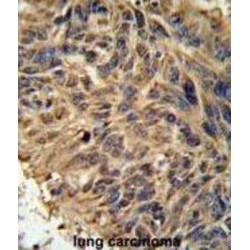 F-Box/LRR-Repeat Protein 2 (FBXL2) Antibody