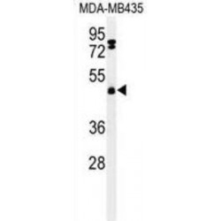 F-Box/LRR-Repeat Protein 2 (FBXL2) Antibody