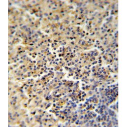 Folate Receptor Beta (FOLR2) Antibody