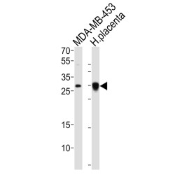Folate Receptor Beta (FOLR2) Antibody