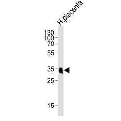Folate Receptor Beta (FOLR2) Antibody