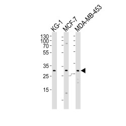 Folate Receptor Beta (FOLR2) Antibody