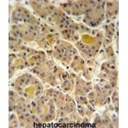 INO80 Complex Subunit D (IN80D) Antibody