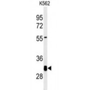 Potassium Channel Tetramerization Domain Containing 7 (KCTD7) Antibody