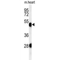 Keratin, Type II Cuticular Hb2 (KRT82) Antibody