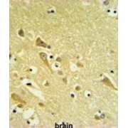 Proteasomal ATPase-Associated Factor 1 (PAAF1) Antibody
