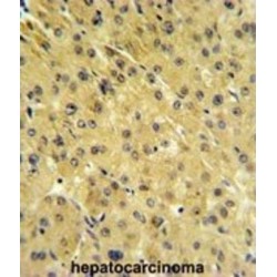 Prostate-Specific Membrane Antigen-Like Protein (PSMAL) Antibody