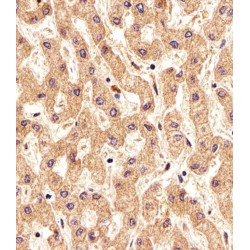 Prostate-Specific Membrane Antigen-Like Protein (PSMAL) Antibody