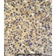 Tumor Protein P63-Regulated Gene 1-Like Protein (TPRGL) Antibody