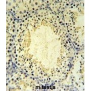 UBX Domain-Containing Protein 6 (UBXN6) Antibody