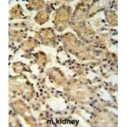 X-Box-Binding Protein 1 (XBP1) Antibody