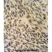 X-Ray Repair Cross Complementing 6 (XRCC6) Antibody
