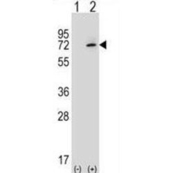 X-Ray Repair Cross Complementing 6 (XRCC6) Antibody