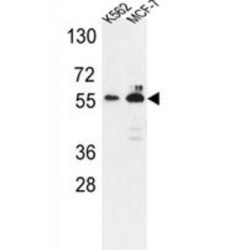 Glucose-6-Phosphate Dehydrogenase (G6PD) Antibody