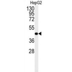 Nuclear Receptor Subfamily 5 Group A Member 1 (NR5A1) Antibody