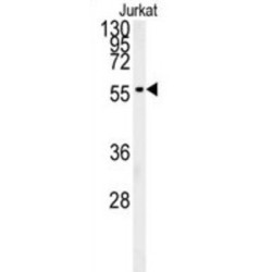 Perilipin-2 (PLIN2) Antibody