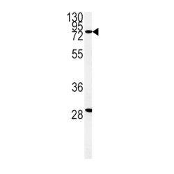 Zinc Finger FYVE Domain-Containing Protein 16 (ZFYVE16) Antibody