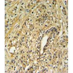 Estradiol 17-Beta-Dehydrogenase 2 (HSD17B2) Antibody