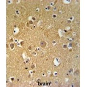 Tubulin Beta-2C Chain (TUBB2C) Antibody