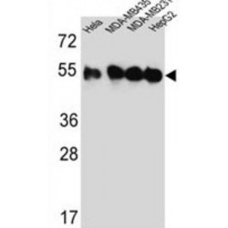 Tubulin Beta-2C Chain (TUBB2C) Antibody