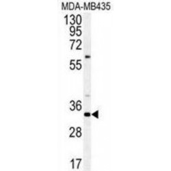 SAGA Complex Associated Factor 29 (SGF29) Antibody