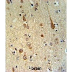 Fatty Acid Amide Hydrolase 2 (FAAH2) Antibody