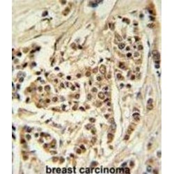 Alpha-Tocopherol Transfer Protein-Like (TTPAL) Antibody
