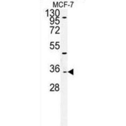 Alpha-Tocopherol Transfer Protein-Like (TTPAL) Antibody
