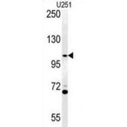 Arf-GAP With Coiled-Coil, ANK Repeat And PH Domain Containing Protein 3 (ACAP3) Antibody