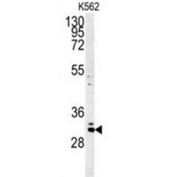 Chromosome 2 Open Reading Frame 49 (C2orf49) Antibody