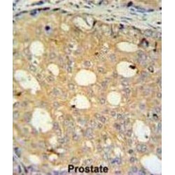 UMP-CMP Kinase 2, Mitochondrial (CMPK2) Antibody
