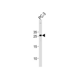 Homeobox Protein Hox-C6 (HOXC6) Antibody
