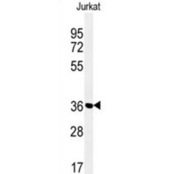 MFRN2 Antibody