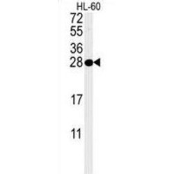 Proteasome Activator Subunit 1 (PSME1) Antibody