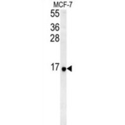Ribosomal Protein S26 (RPS26) Antibody