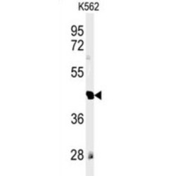 Reticulon-4 Receptor-Like 1 (RTN4RL1) Antibody