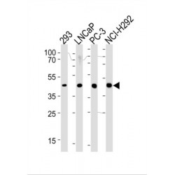 Polyprenol Reductase (SRD5A3) Antibody