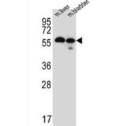 Transmembrane Protein 87B (TMEM87B) Antibody