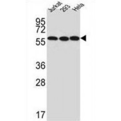 U3 Small Nucleolar RNA-Associated Protein 6 Homolog (UTP6) Antibody