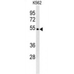 WD Repeat-Containing Protein 73 (WDR73) Antibody