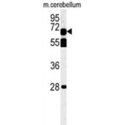 abx032476