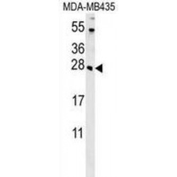 Tetraspanin 30 / TSPAN30 (CD63) Antibody